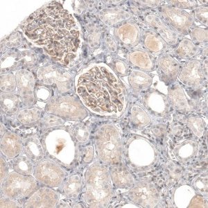 Anti-NCR3LG1 antibody produced in rabbit 