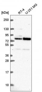 Anti-NDC80 antibody produced in rabbit 