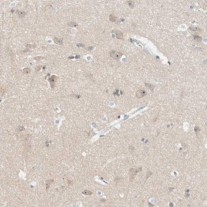 Anti-NDE1 antibody produced in rabbit HPA024075-100UL