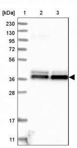 Anti-NDE1 antibody produced in rabbit HPA024075-100UL