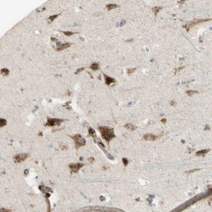 Anti-NDFIP1 antibody produced in rabbit HPA009682-100UL