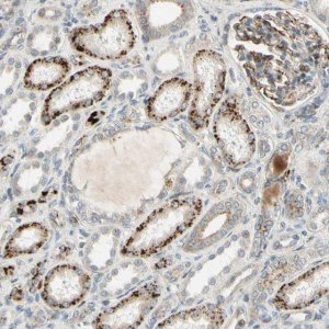 Anti-NDFIP1 antibody produced in rabbit HPA009682-100UL