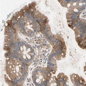 Anti-NDFIP2 antibody produced in rabbit 