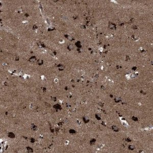 Anti-NDUFA2 antibody produced in rabbit HPA035933-100UL