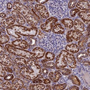 Anti-NDUFB9 antibody produced in rabbit HPA042768-100UL