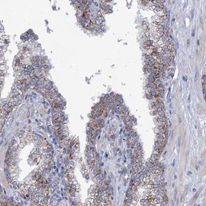 Anti-NDUFC2 antibody produced in rabbit HPA038873-100UL