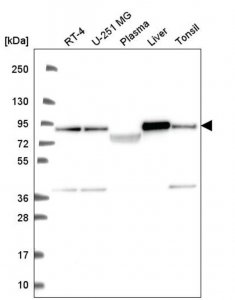 Anti-NDUFS1 antibody produced in rabbit 