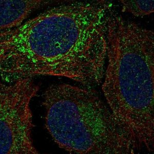 Anti-NDUFV2 antibody produced in rabbit 