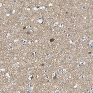 Anti-NEGR1 antibody produced in rabbit 