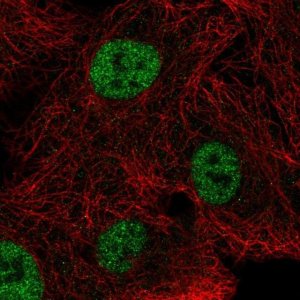 Anti-NEIL2 antibody produced in rabbit 