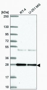 Anti-NEIL2 antibody produced in rabbit HPA064460-100UL