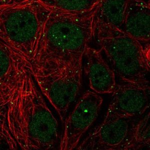 Anti-NELFCD antibody produced in rabbit 