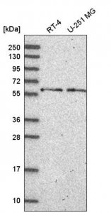 Anti-NELFCD antibody produced in rabbit 