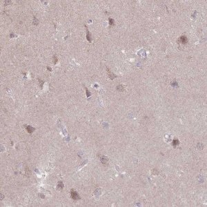 Anti-NELL1 antibody produced in rabbit 