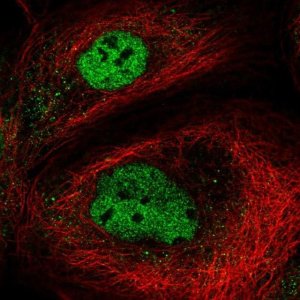 Anti-NEMP2 antibody produced in rabbit 