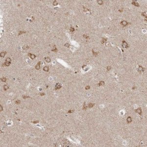 Anti-NENF antibody produced in rabbit 