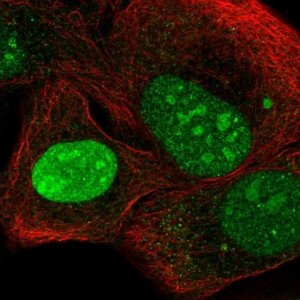 Anti-NEPRO antibody produced in rabbit 