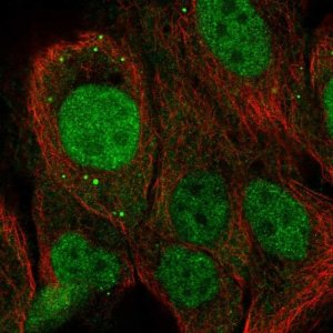 Anti-NET1 antibody produced in rabbit 