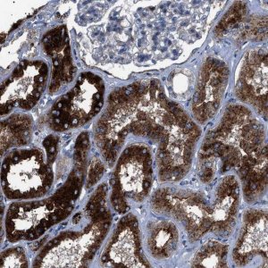 Anti-NEU1 antibody produced in rabbit 
