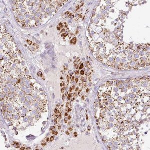 Anti-NF1 antibody produced in rabbit 