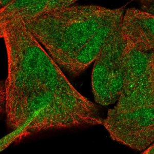 Anti-NFE2L1 antibody produced in rabbit 