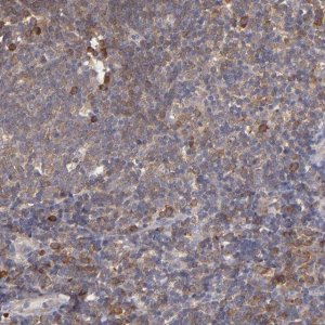 Anti-NFKBIE antibody produced in rabbit 