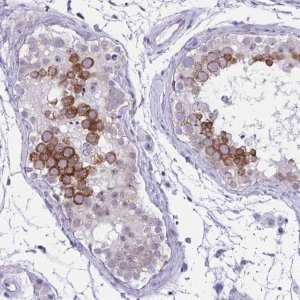Anti-NFXL1 antibody produced in rabbit 