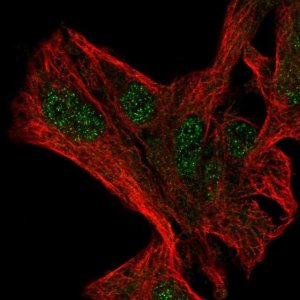 Anti-NFXL1 antibody produced in rabbit 