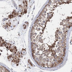 Anti-NGLY1 antibody produced in rabbit 