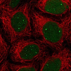 Anti-NHEJ1 antibody produced in rabbit 