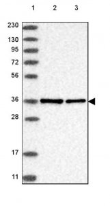 Anti-NIFK antibody produced in rabbit 