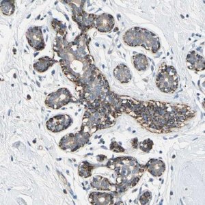 Anti-NIM1K antibody produced in rabbit 