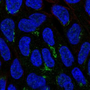 Anti-NIPAL1 antibody produced in rabbit 