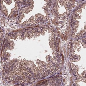Anti-NIPAL2 antibody produced in rabbit 
