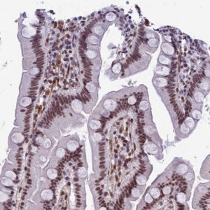 Anti-NIPBL antibody produced in rabbit 