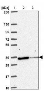Anti-NIPSNAP1 antibody produced in rabbit HPA059227-100UL