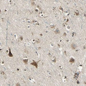 Anti-NIT1 antibody produced in rabbit HPA006657-100UL