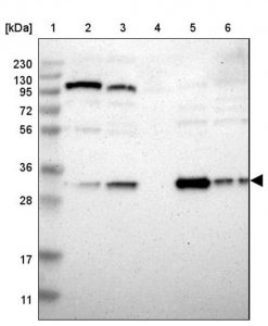 Anti-NIT1 antibody produced in rabbit HPA006657-100UL