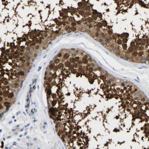 Anti-NKAIN3 antibody produced in rabbit 