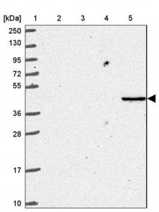 Anti-NKD2 antibody produced in rabbit 