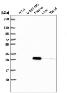 Anti-NKX2-5 antibody produced in rabbit 