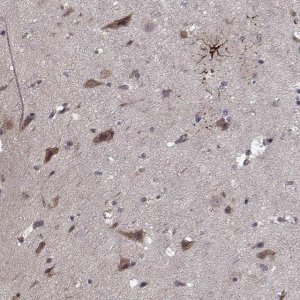 Anti-NLK antibody produced in rabbit 
