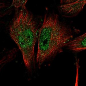 Anti-NLK antibody produced in rabbit 