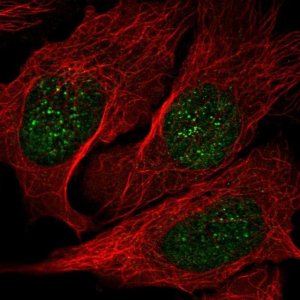 Anti-NME3 antibody produced in rabbit 
