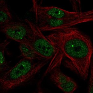 Anti-NME5 antibody produced in rabbit 