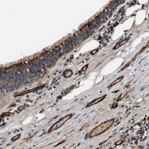 Anti-NME6 antibody produced in rabbit 