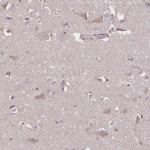 Anti-NOG antibody produced in rabbit 