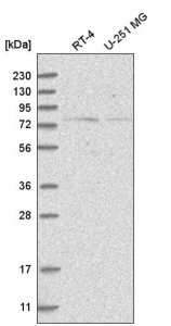 Anti-NOL10 antibody produced in rabbit HPA035286-100UL