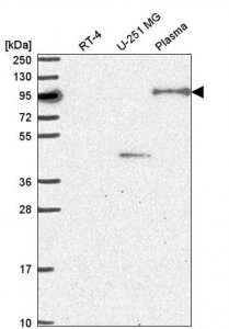 Anti-NOM1 antibody produced in rabbit 