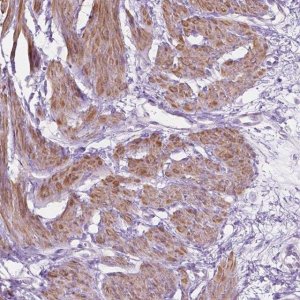 Anti-NOS1AP antibody produced in rabbit 